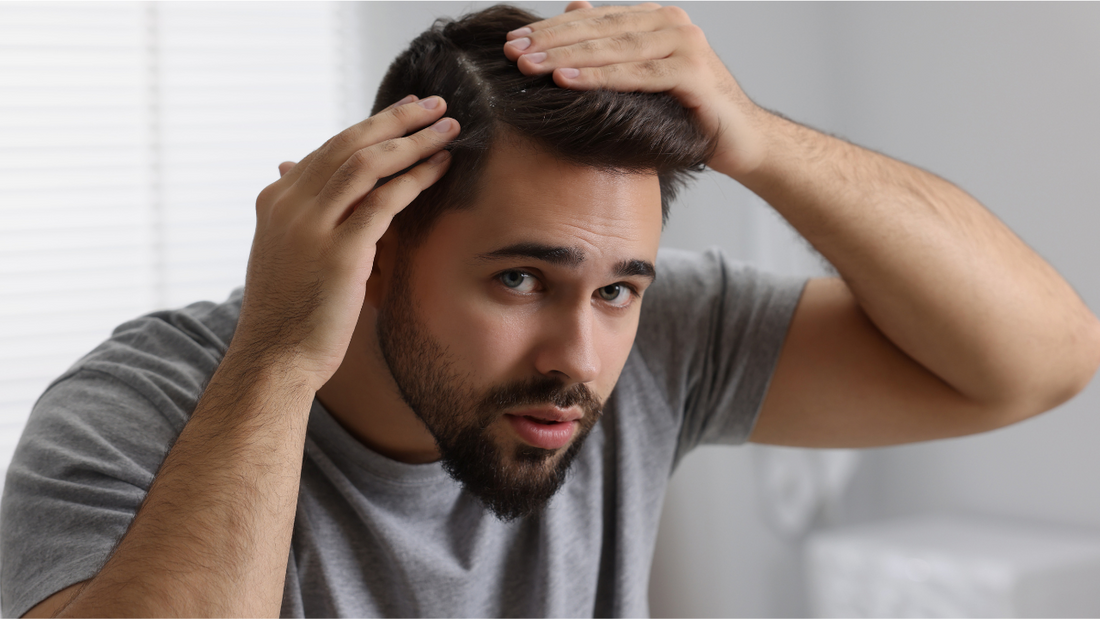 Dandruff Solutions That Work: Why Keshalka Hair Oil is the Best Ayurvedic Choice